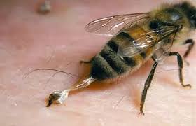 درمان کرونا با نیش زنبور عسل