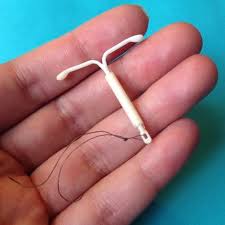 IUD یکی از روشهای جلوگیری از بارداری 