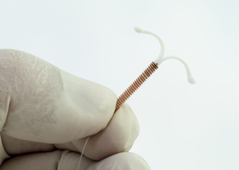 روشهای سنتی جلوگیری از بارداریبا IUD 